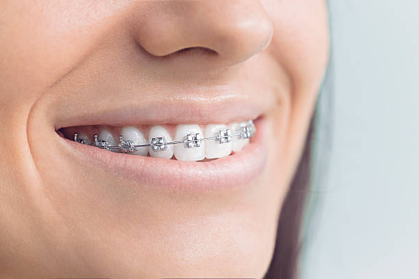 Best Dental Inlays and Onlays  in Trabuco Nyon, CA